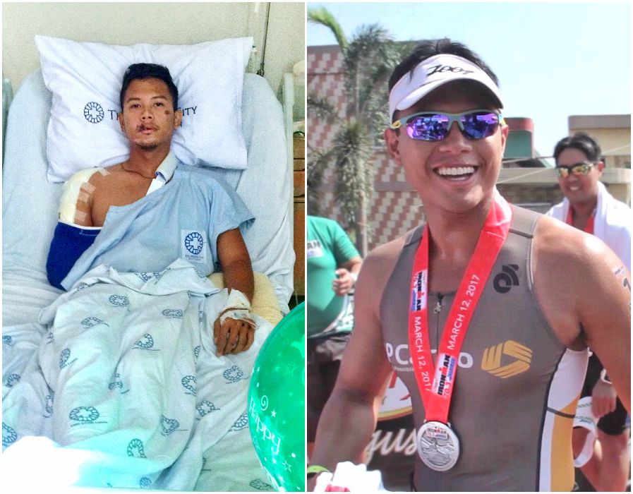 The bike accident left Kevin Lapeña with injuries including a fractured arm and jaw, a dislocated shoulder, and temporary memory loss