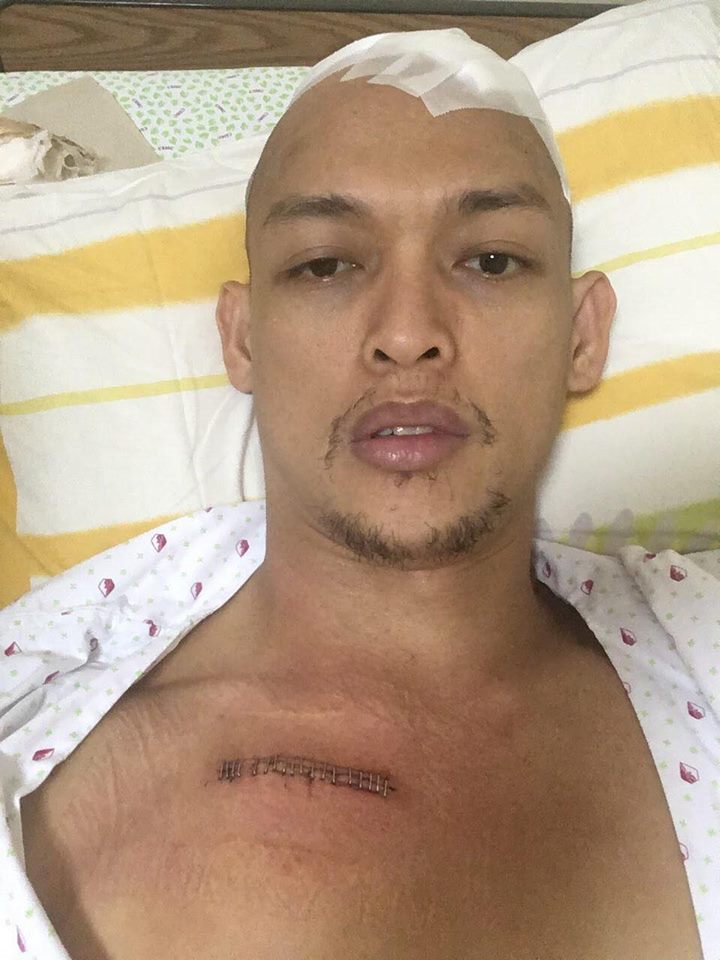JP Anthony Cuñada post-surgery as a result of his dystonia diagnosis